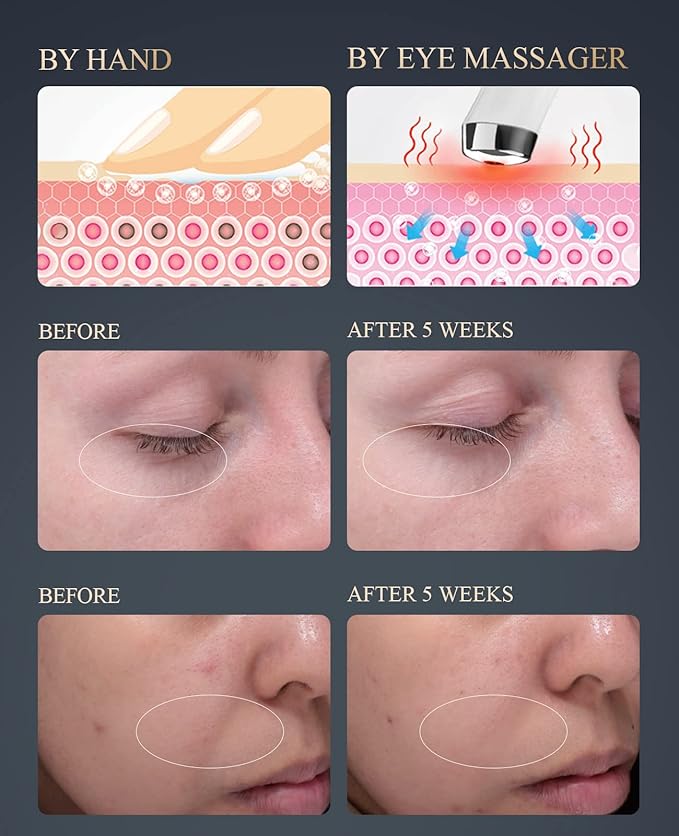 TOUCHBeauty Eye Massager Wand with 40℃, Eye Cream Booster with Heat/Vibrαtion/Red Mode, Fine Lines Remover TB-1662