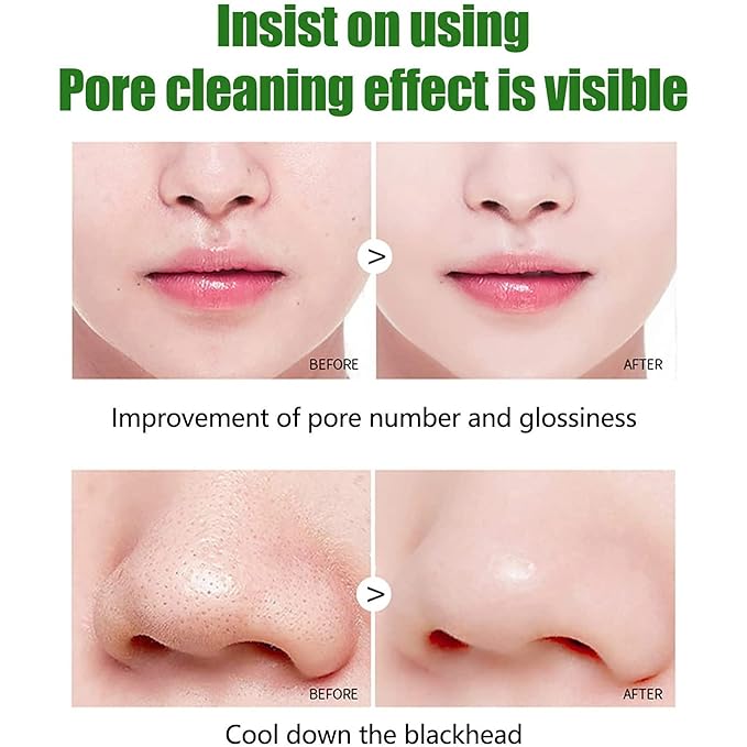 Green Tea Blackhead Remover Mask Stick for Face, Deep Cleansing, Poreless Skin Treatment, Unisex