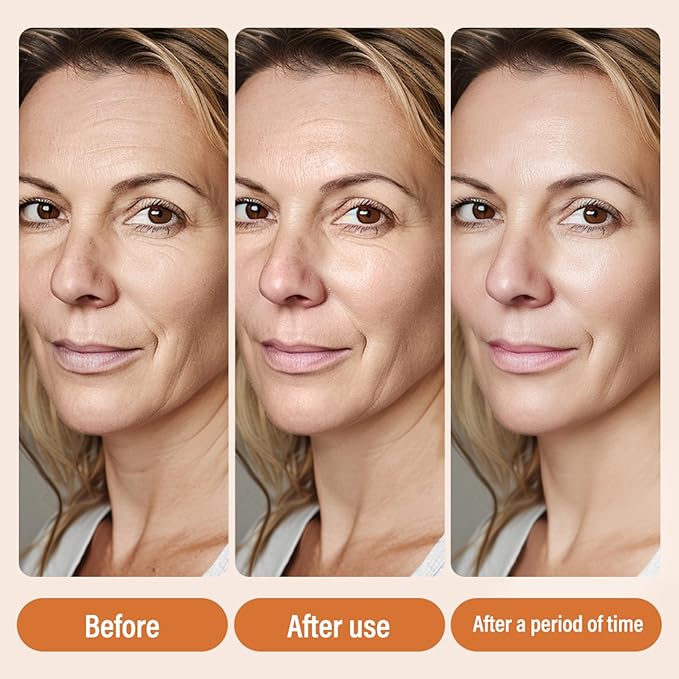 Vitamin C Serum for Women Over 70, Vitamin C Serum for Mature Skin Care Hydrate & Plump Skin Care Anti Aging Wrinkle