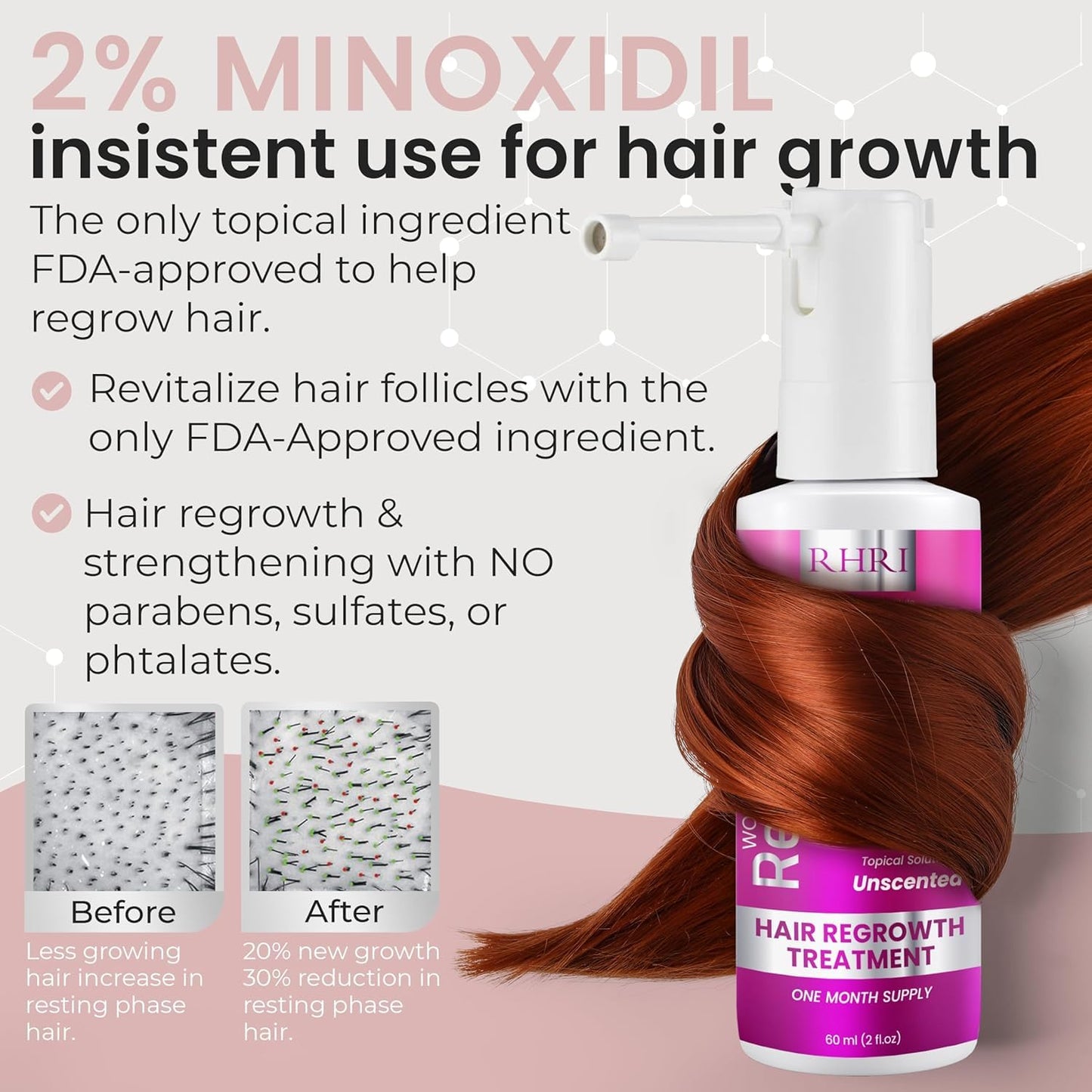 2% Minoxidil for Women Hair Regrowth Spray– Minoxidil Thicker & Fuller Topical Solution for Hair Loss Treatment, Follicle Reactivation - 60 ml (Pack of 2)