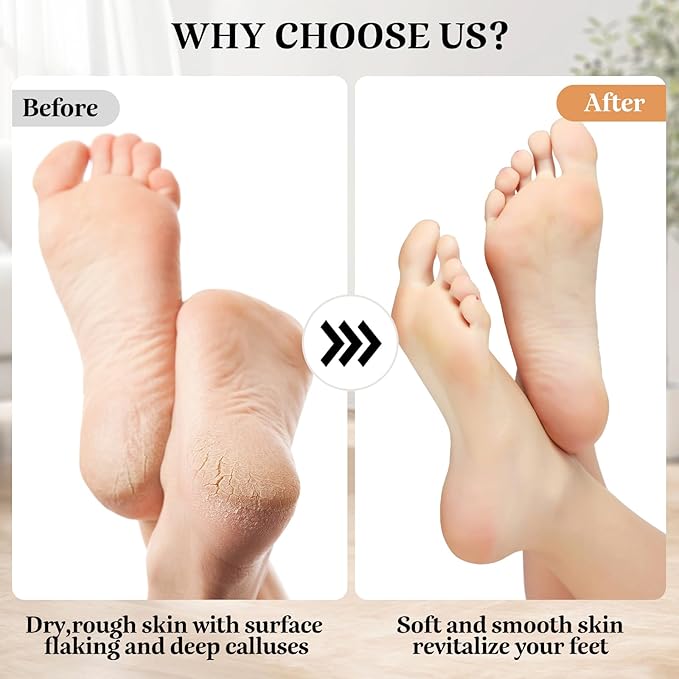 Electric Callus Remover Foot File - Rechargeable Callus Remover Pedicure Tools for Feet Foot Scrubber File Foot Care Grinder with 3 Grinding Heads 2 Speeds for Men Women Dry Callus Dead Skin (Orange)