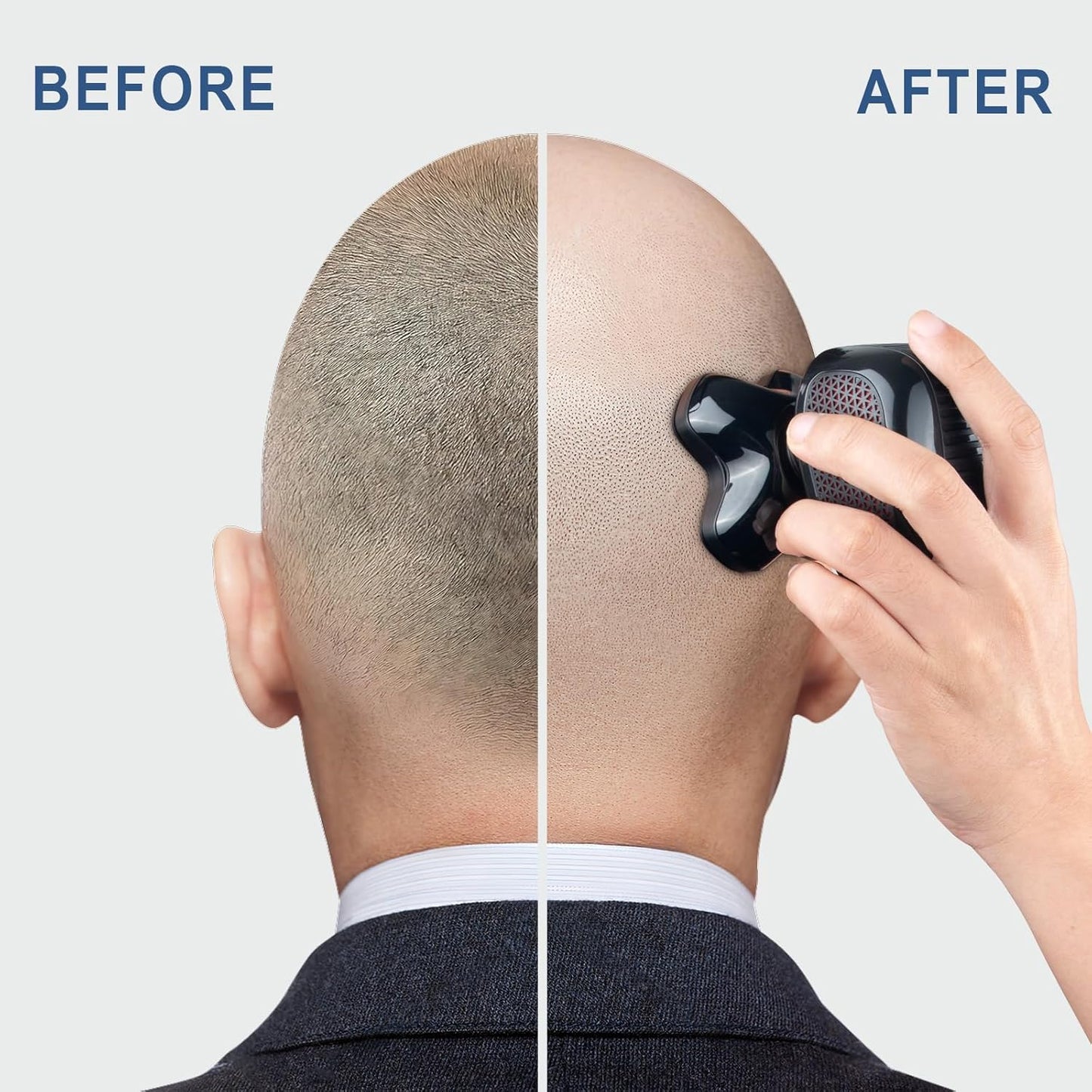 Telfun Magnetic Head Shavers for Bald Men, Cordless 5-in-1 Electric Razor for Fast Shaving- IPX7 Waterproof Wet/Dry Mens Grooming Kit - Easy Use Palm Shaver for a Smooth Bald Shave