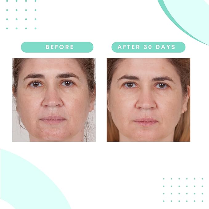 Serious Skincare Glycolic Acid Retexturizing Serum with Balancing Blue Tansy Extract - Diminish Lines & Wrinkles - Soften Rough Skin Texture - AHA - Anti-Aging Skin Treatment - 1 oz.