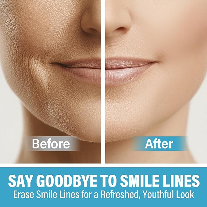 Smile Line Patches, Anti Wrinkle Patches for Face Overnight, Face Wrinkle Patches for Fine Lines Around Mouth & between Eyes,16 Packs