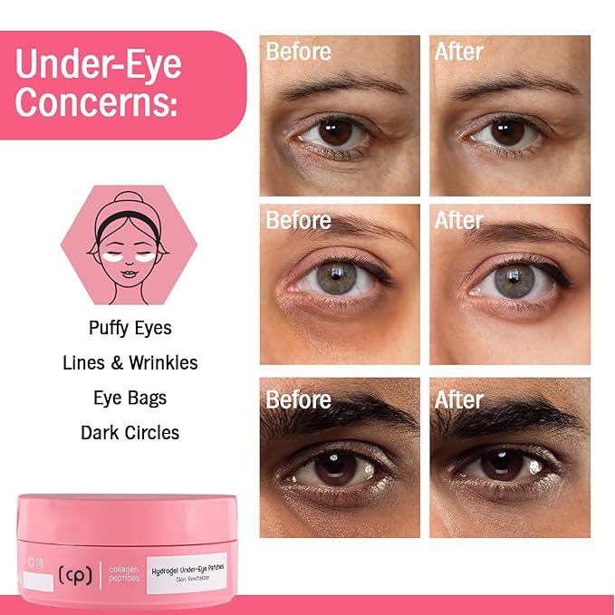 Pure Collagen Hydrogel Under Eye Patches & Peptides Skin Revitalizer, Anti Aging Skin Brightener, Treats Dark Circles, Puffy Eyes, Crow's Feet, Fine Lines & Wrinkles. Vegan. 60Pcs
