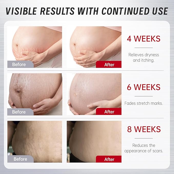 VGO Body Oil with Vitamin E, After Shower Body Oil for Women, Non-Greasy & Fast-Absorbing Lightweight Moisturizer for Scars & Stretch Marks, Hydrating for Dry Sensitive Skin