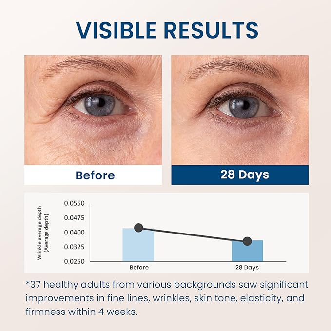 5% Caffeine 5% Retinol Eye Cream for Dark Circles, Puffiness and Bags, Hyaluronic Acid and Niacinamide Under Eye Cream Anti Aging, Eye Serum for Fine Lines, 360° Eye Massage Ball Roller