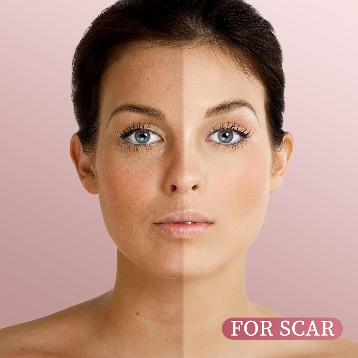 Rosehip Seed Oil For Face,100% Pure Rosehip oils For Skin,Scars,Hair & Nails.4 fl Oz Cold Pressed Rose Hips Oil For Skin Care, Anti-Aging, Scar Treatment, GUA SHA Massage DIY (4 Fl Oz)