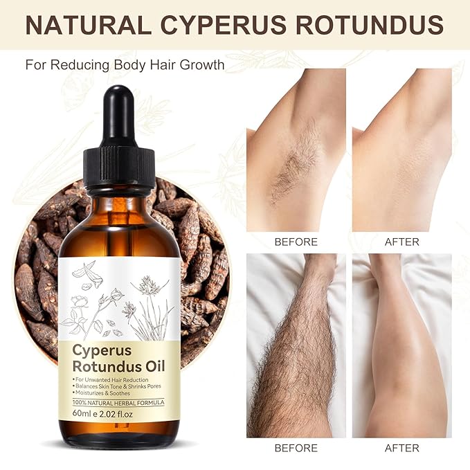 Cypress Rotunda Oil - Reduces Hair Growth - Shrinks Pores-Moisturizes and Soothes - Balances Skin Tone - for Face, Body, Arms - 60ml