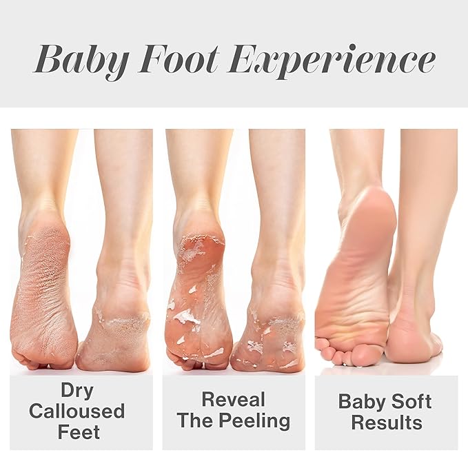 Baby Foot Original Exfoliation Foot Peel - Callus Remover for Rough Cracked, Dry Feet, Dead Skin Removal - Foot Peeling Mask for Baby Soft Feet - Spa Experience at Home & Gift Ideas - Lavender Scented