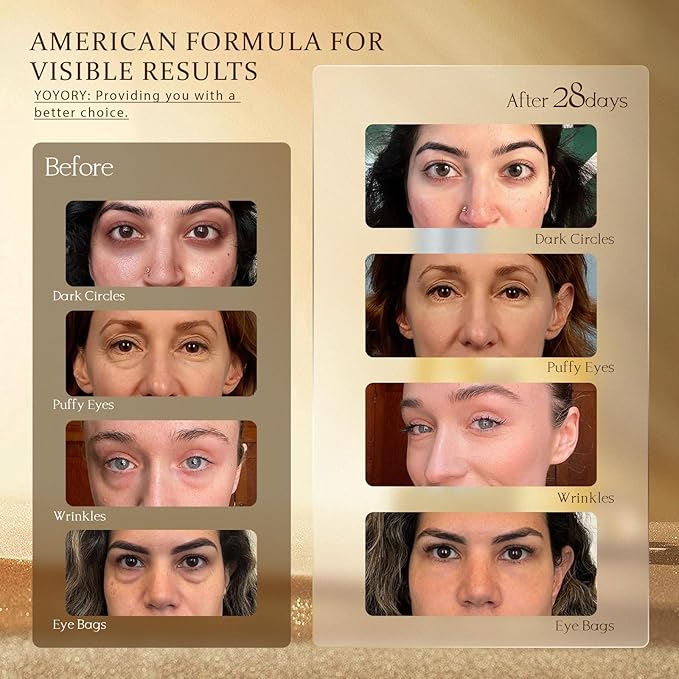 Retinol Under Eye Cream - Anti-aging Eye Cream for Eye Bags, Dark Circles, and Fade Wrinkles, Fine Lines Skin Care Treatment for Women and Men, Gold(0.67 Fl Oz)