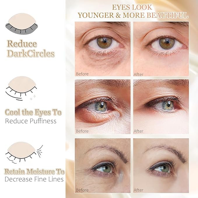 MOND'SUB Under Eye Mask - 6 Pairs Banana Crystal Eye Mask - Puffy Eyes & Dark Circles Treatments with Hyaluronic Acid, Reduce Under Eye Bags and Smooth Wrinkles, Brighten Complexion