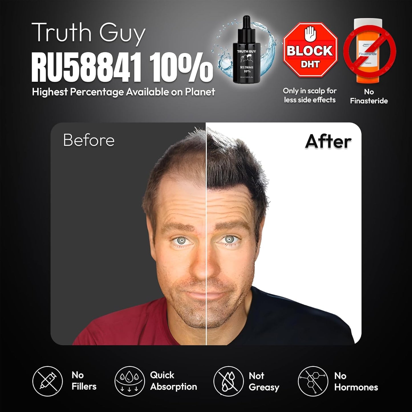 Truth Guy RU58841 10% Hair Serum for Men – Powerful DHT Blocker with Maximum Strength – Targets Male Pattern Thinning and Receding Hairline – Promotes Fuller, Healthier-Looking, Stronger Hair – 30 ml