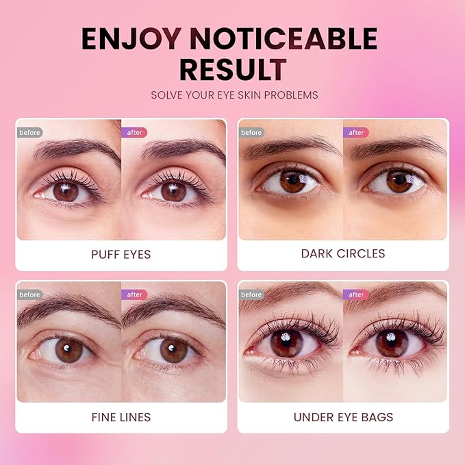 Under Eye Patches (36 Pairs) - New Tri-color Glitter Eye Gel Pads for Dark Circles Puffy Eyes,Under eye Bags,Wrinkles|Natural Collagen Under Eye Mask Patches, Gel Under Eye Patches