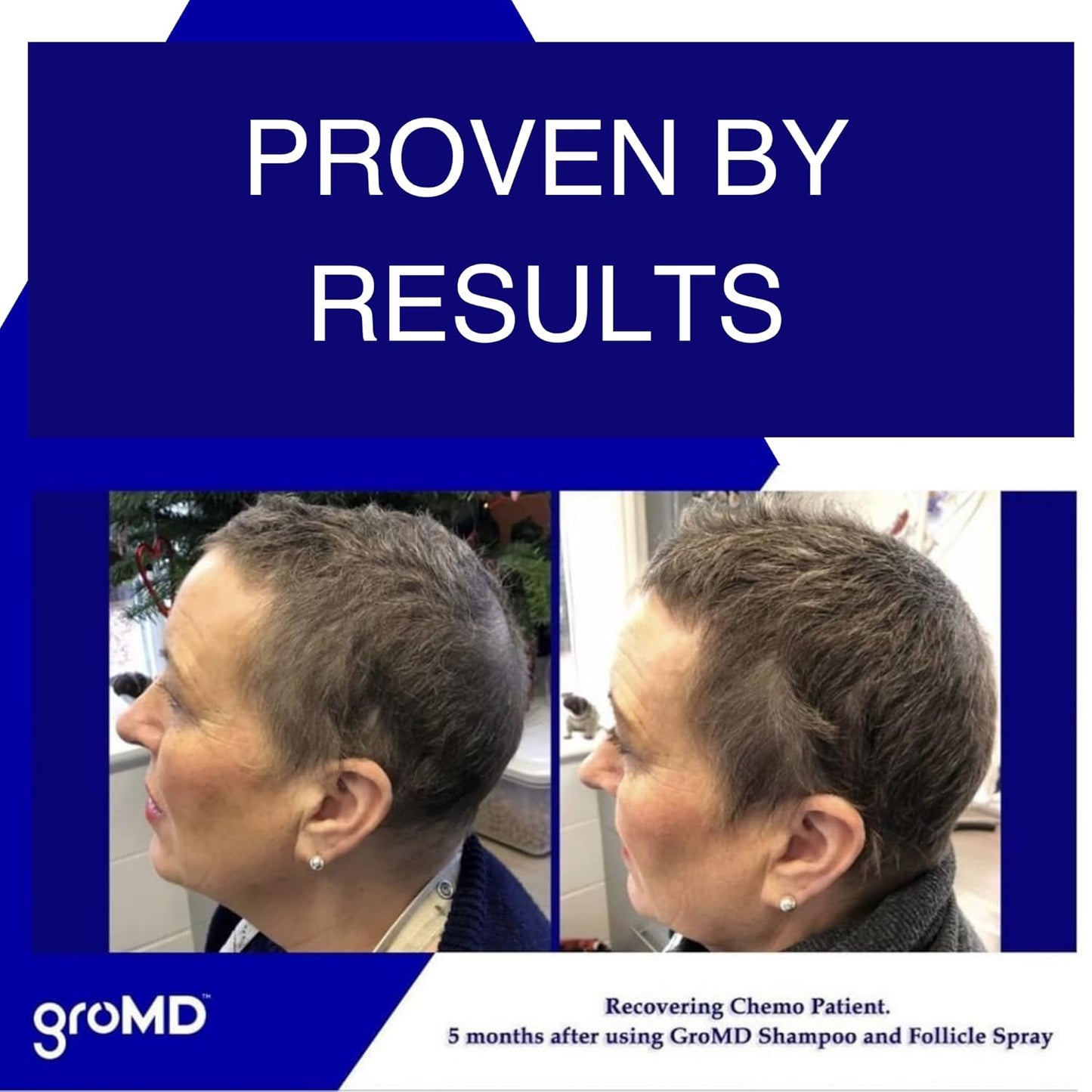 GroMD Biotin Shampoo and Conditioner, Hair Growth Shampoo, Hair Loss Shampoo for Men & Women, Regrowth Treatment & Thickening, Contains Argan Oil & DHT Blocking Ingredients, Doctor-Formulated, 10 oz