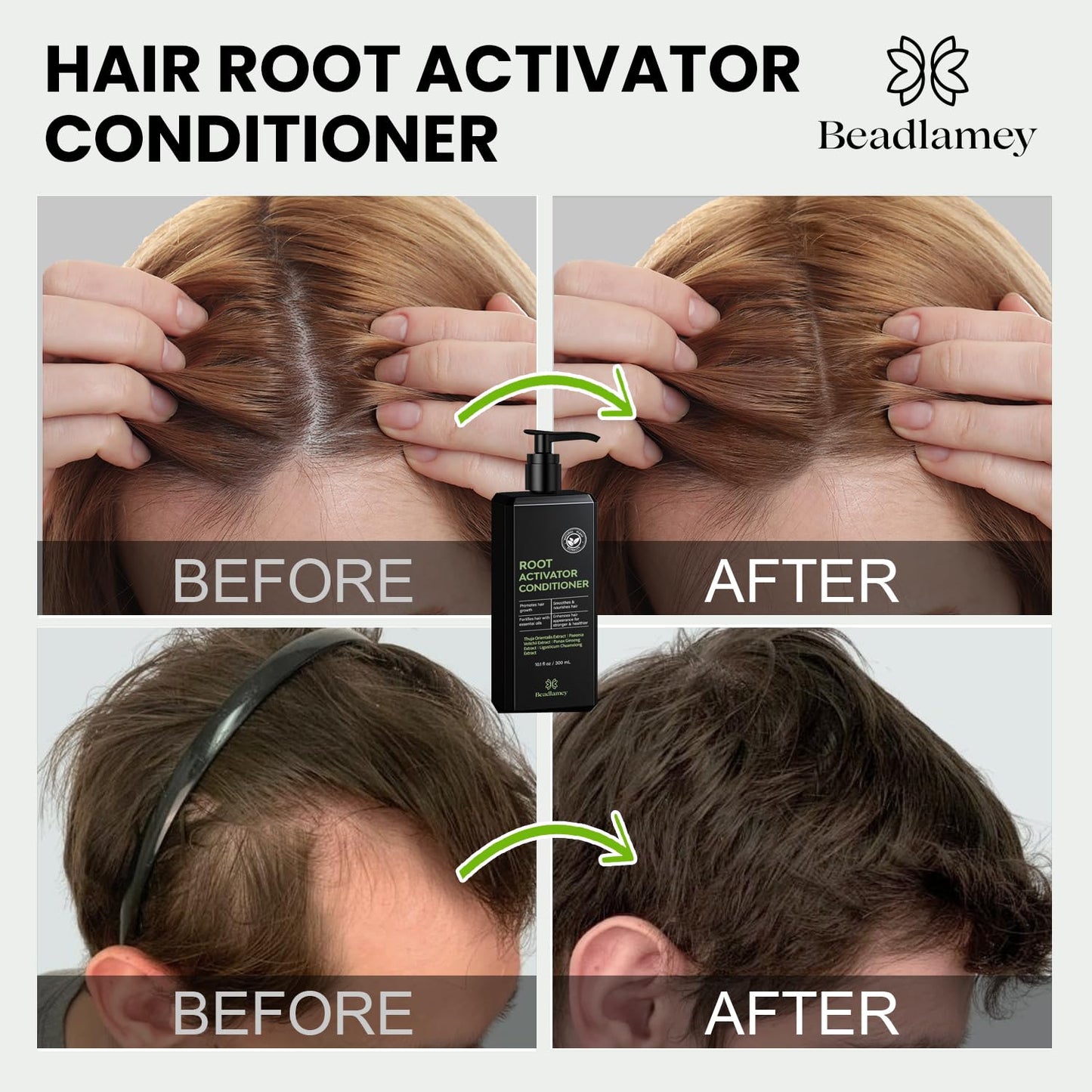 Root Activator Conditioner for Men and Women: Hair Growth Conditioner for Hair Loss and Thinning Hair - Smoothes, Nourishes & Fortifies Hair for Healthier Look- 10.1 fl oz / 300 mL