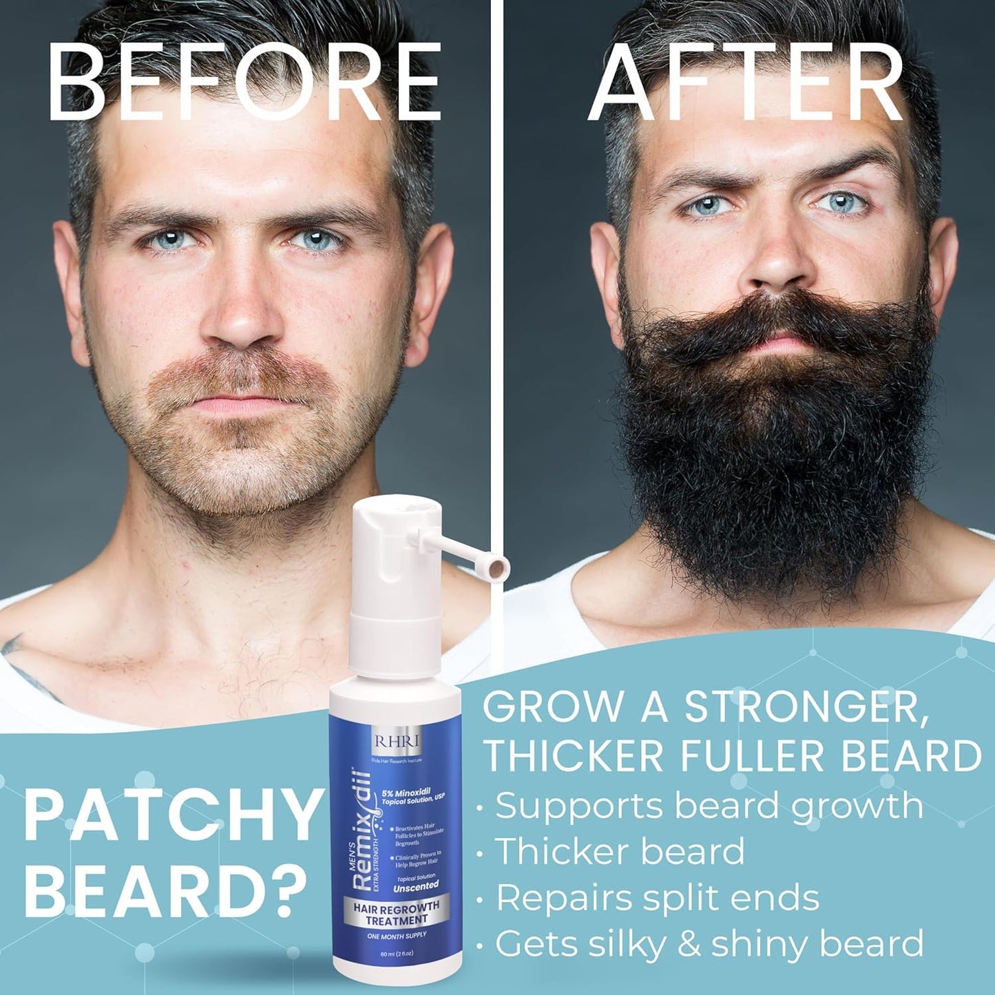 5% Minoxidil for Men Hair Regrowth Spray – Minoxidil Thicker & Fuller Topical Solution for Hair Loss Treatment, Follicle Reactivation - 60 ml (Pack of 2)