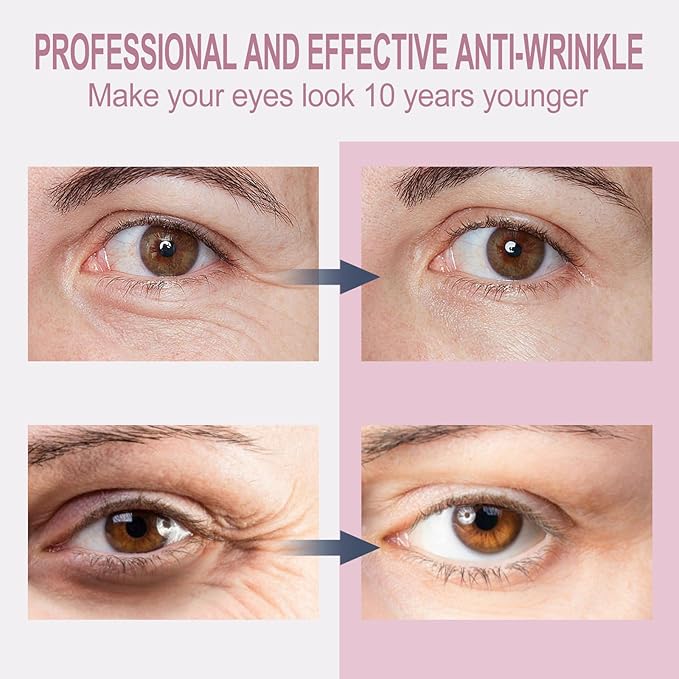 Temporary Eye Tightener Eye Cream - Retinol & Hyaluronic Acid Infused Formula, Quickly Repairs Wrinkles While Reducing Under-Eye Bags & Dark Circles, Daily Anti-Aging Care, 0.68 oz