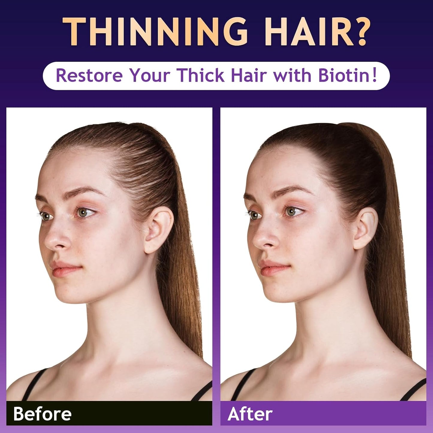 Biotin Hair Growth & Thickening Shampoo with Root Activator, Hair Loss Shampoo for Men And Women, Strengthen Roots, Control Oil & Thicken Thin Hair, Sulfate-Free, for All Hair Types, 10.1 Fl Oz