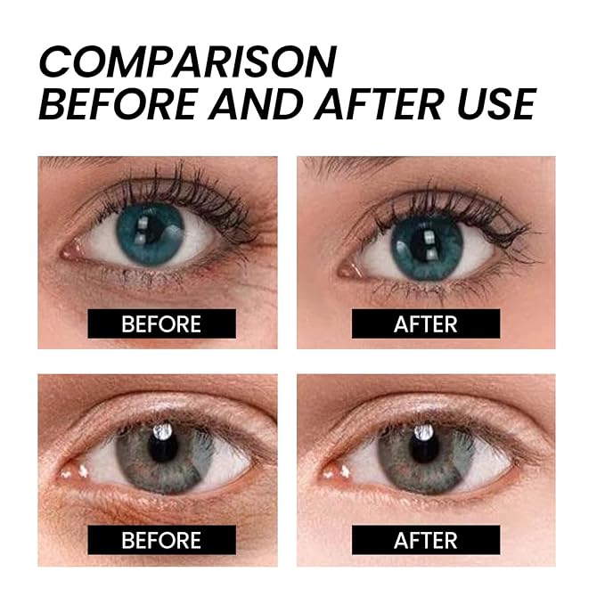 Instant Firming Eye Cream,Temporary Eye Tightener for Under-Eye Bags,Dark Circles & Puffiness|Anti-Aging Face Lift Cream to Smooth Fine Lines (1)