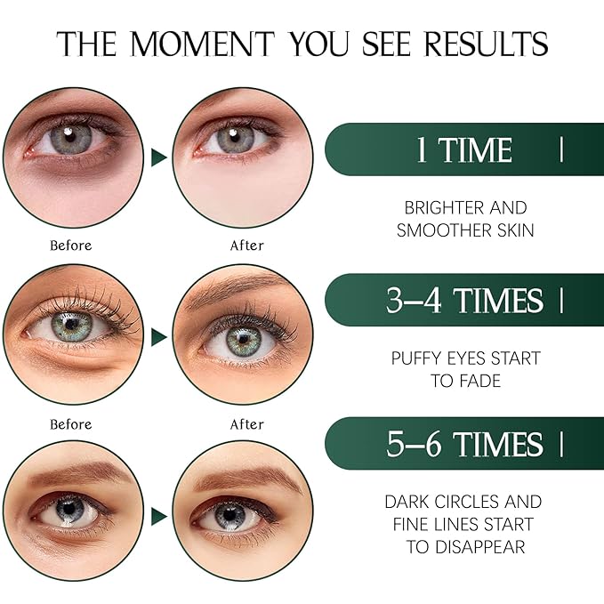 Tiepetly Under Eye Masks with Collagen, Green Tea Eye Patches for Dark Circles and Puffiness, Hydrating, Anti Wrinkle, 60 pcs