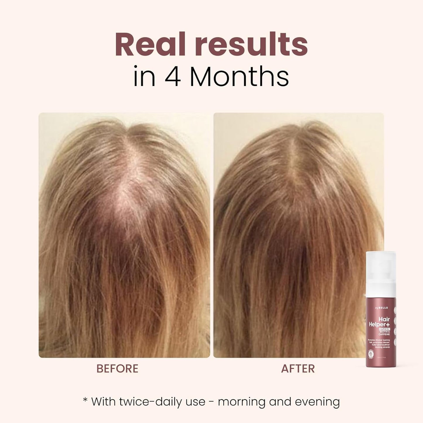 Trybello Hair Helper + Spray | Hair Growth Serum, powered by Capixyl | With Biotin, Castor Oil, Caffeine, Rice Water & Peptide Complex | Natural Treatment for Thicker, Fuller Strands | Vegan Formula