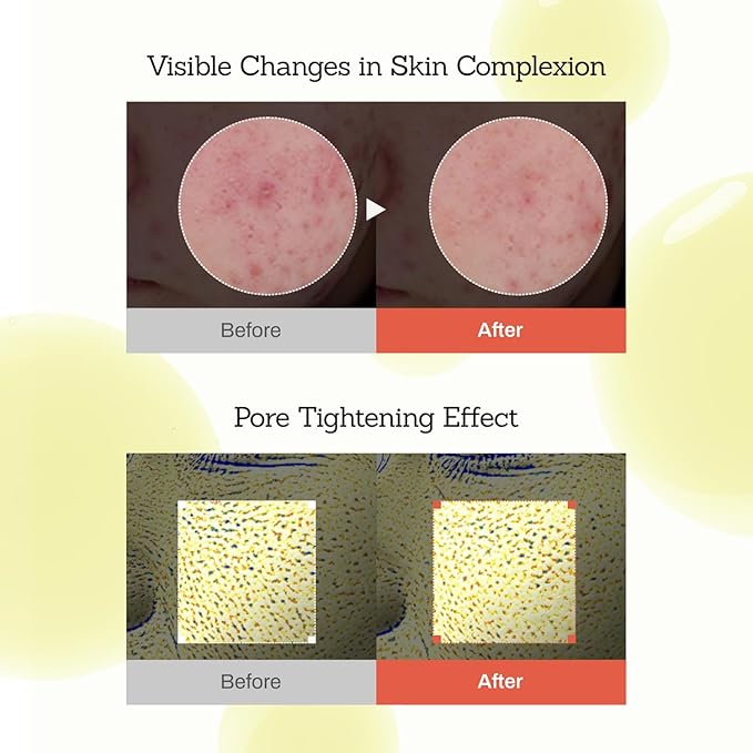 MEDITHERAPY Retinal Skin Booster Serum 5.07 fl. oz - 100ppm Retinal Ideal for Beginner & Sensitive Skin - Advanced Retinol Serum for Face - Retinaldehyde Facial Serum for Uneven Skin Tone & Fine Lines