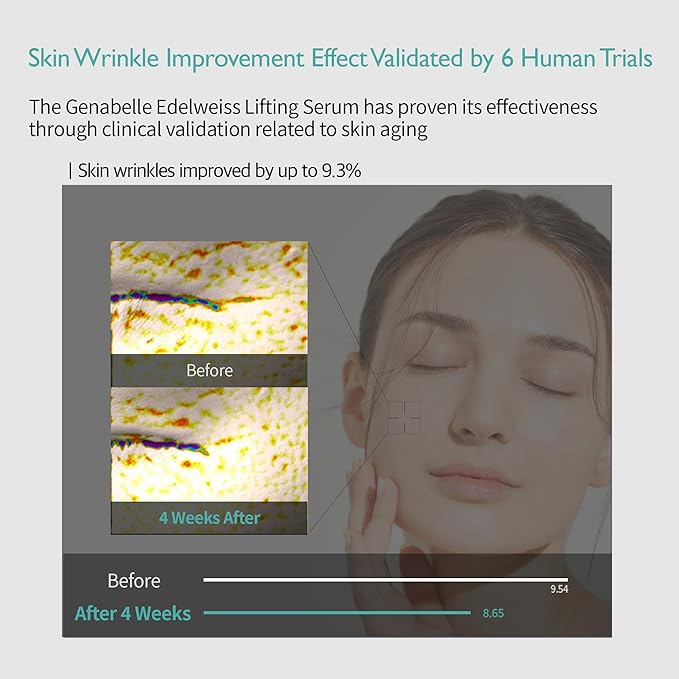 Edelweiss Lifting Serum – Anti-Aging Formula with Edelweiss Extract, Niacinamide, Peptides for Firming, Hydration & Brightening – 1.35 fl.oz