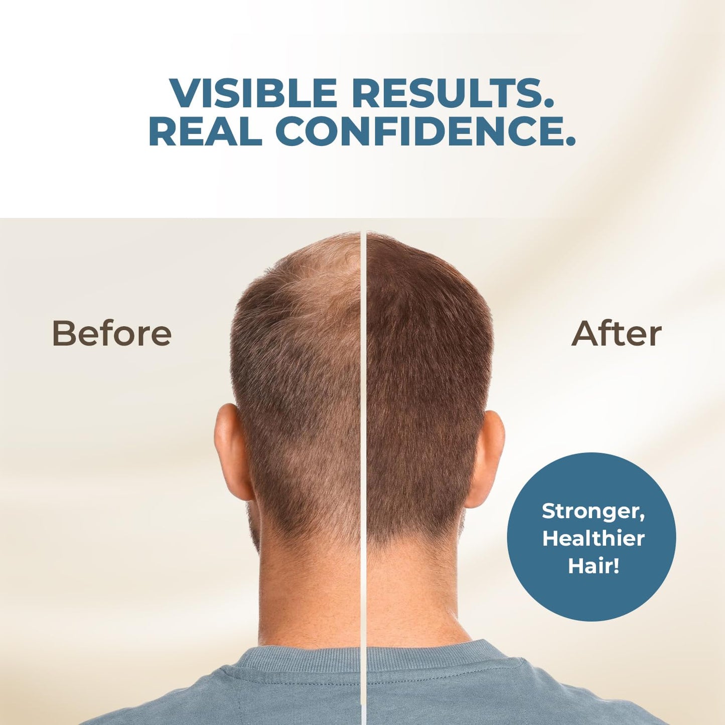 Saw Palmetto Extract Pumpkin Seed Oil for Hair Growth - 10X Potency Targeted Scalp Treatment with Castor, Lavender Scent, Rosemary Oil for Hair 4oz (118ml)