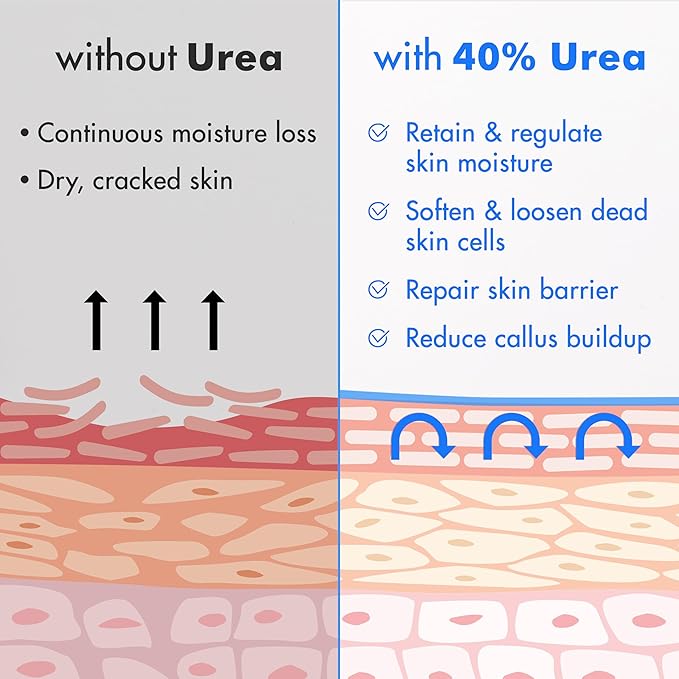 Ebanel Urea Cream 40% plus Salicylic Acid 2%, Foot Cream for Dry Cracked Heels Feet Knees Elbows Hands, Foot Dead Skin Cuticle Callus Remover Toenail Softener, Keratolytic Skin Barrier Repair, 3-Pack