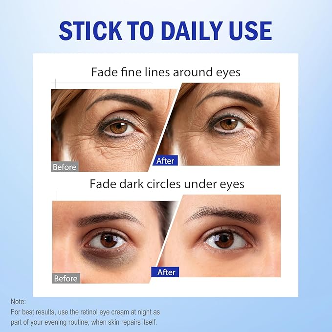 Retinol Eye Cream, Hydrating Under Eye Care Daily Wrinkle Cream, Infused with AHA30% to Smooth and Hydrate Skin, Eye Crea for Dark Circles Treatments, Reduce Under Eye Bags, Smooth Wrinkles, 1Pack