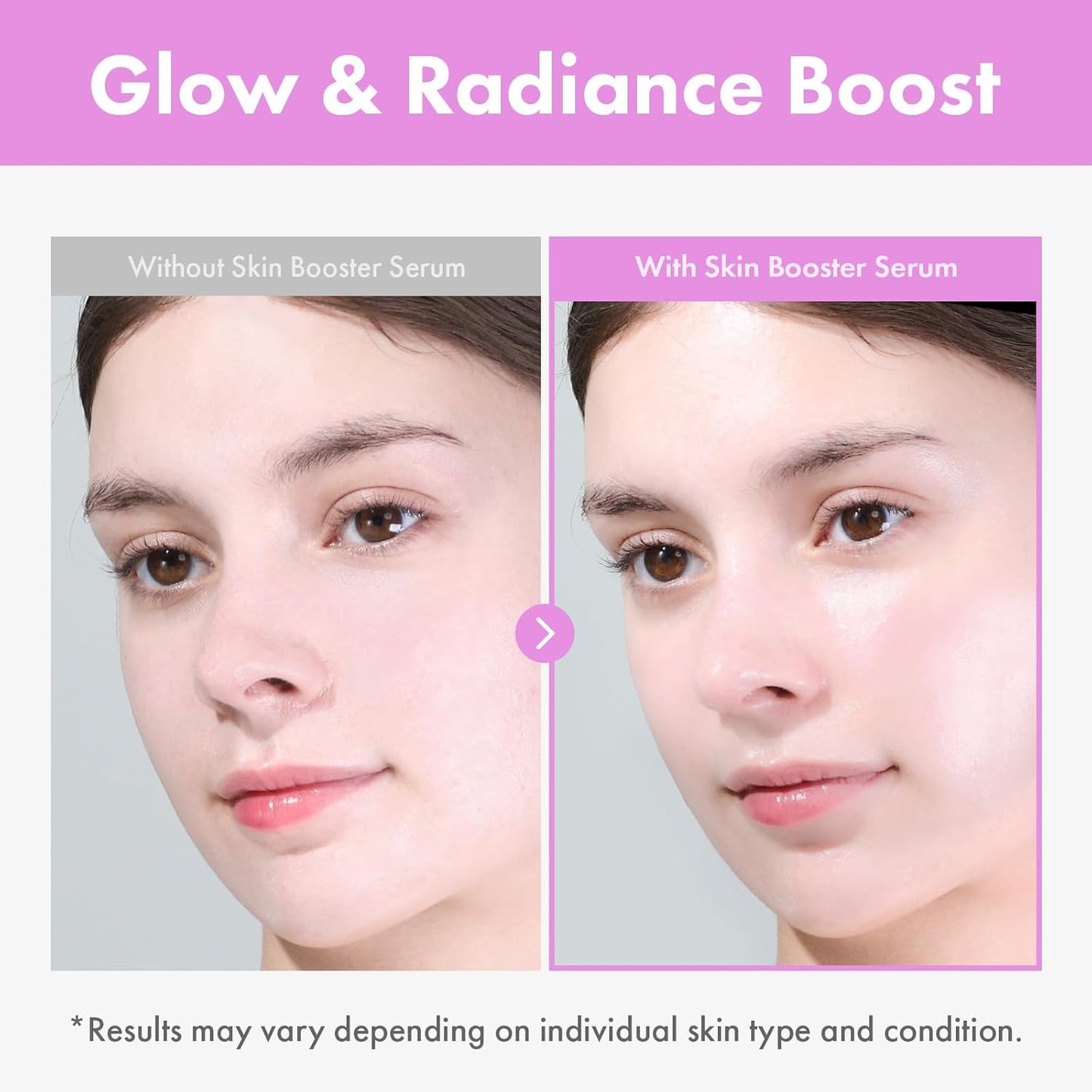 TOSOWOONG 9 Peptide Skin Booster Serum, Niacinamide & Hyaluronic Acid Skin Renewal Boosting Facial Essence for All Skin Types, Korean Skin Care, Paraben Free, 150ml, 5.07 fl.oz.