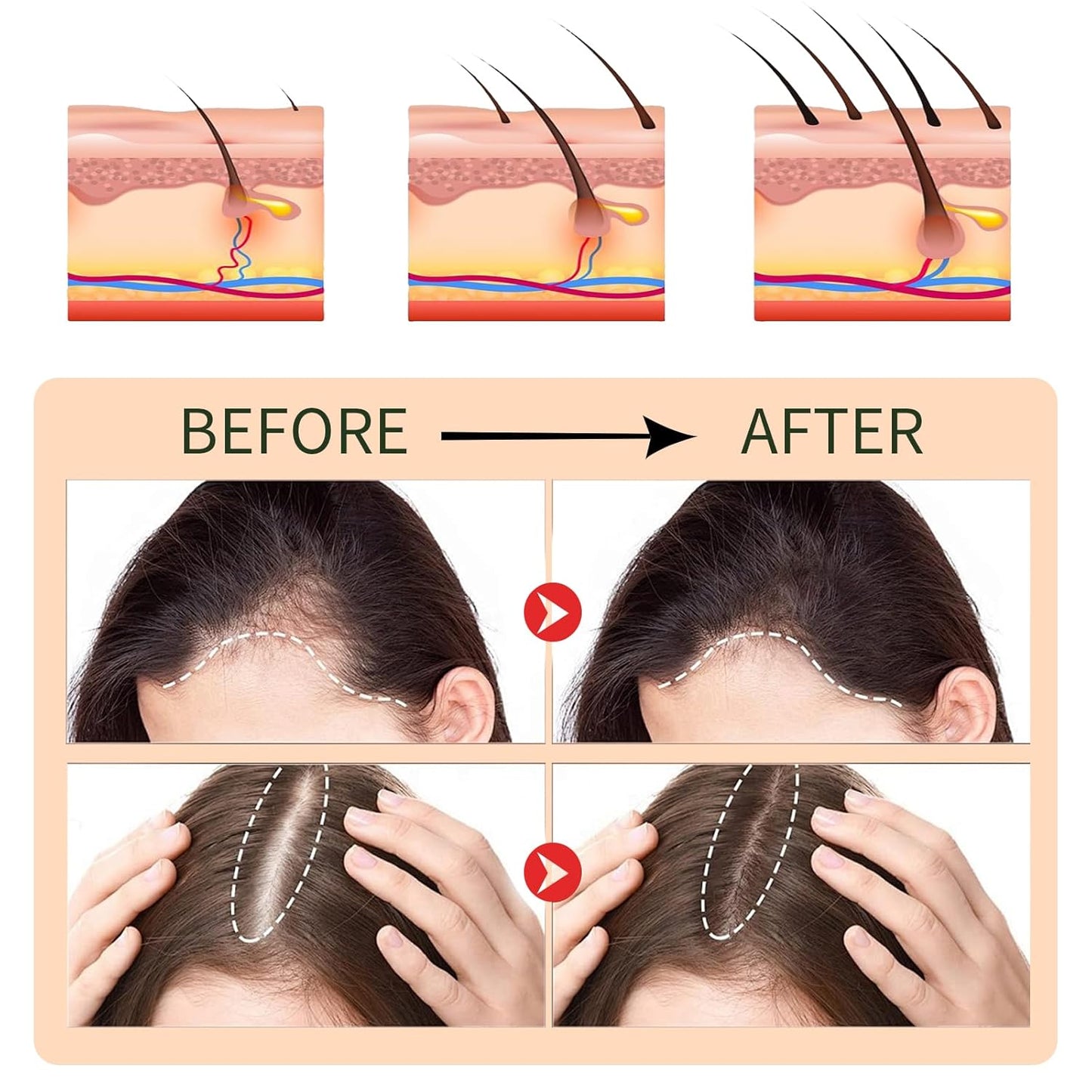 Hair Serum for Hair Loss & Thinning Hair | Hair Growth Oil for Men and Women, 1.05 fl.oz