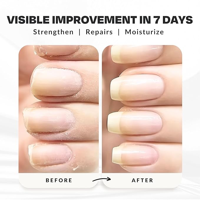 Nail Strengthener Power Boost Growth Formula, Keratin, Biotin, & Vitamin E, 21- Free, Repairs Damaged Nails, Stops Peeling & Chipping, Use as Clear Base Coat & Topcoat .50 fl. Oz. CAKE Nail Treatment