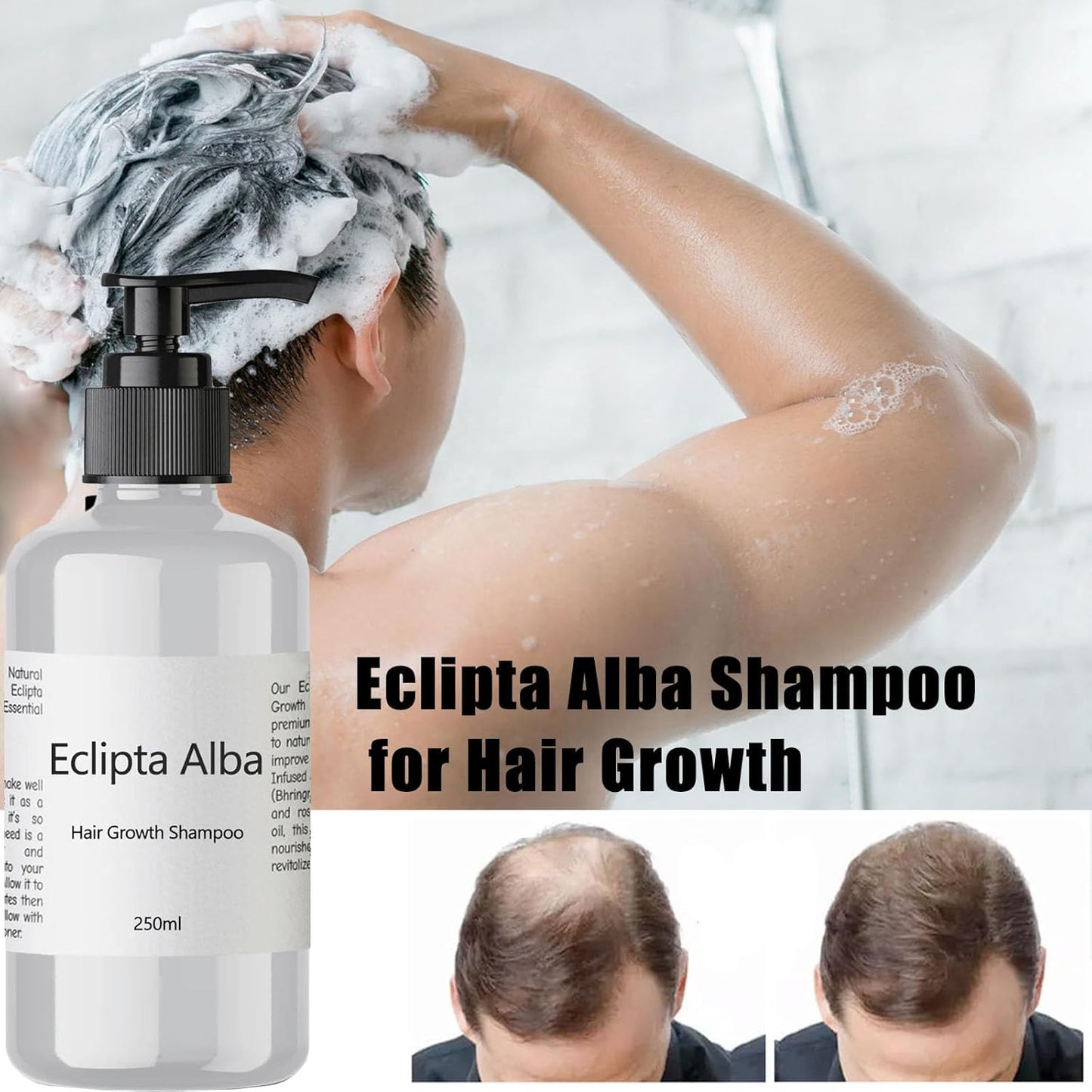 Eclipta Alba Shampoo for Hair Growth with Organic Bhringraj Oil, Strengthens & Nourishes Hair, Prevents Hair Loss, Safe for All Hair Types – 250ml