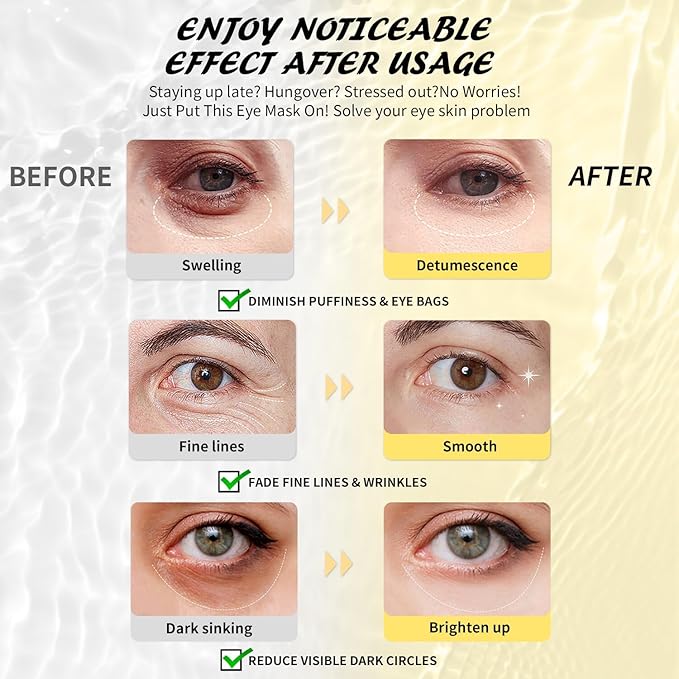 24k Gold Under Eye Patches & Hyaluronic Acid Eye Masks, Collagen Eye Patches for Dark Circles Undereye Bags Wrinkles and Puffiness, Eye Skin Care Gift for Her