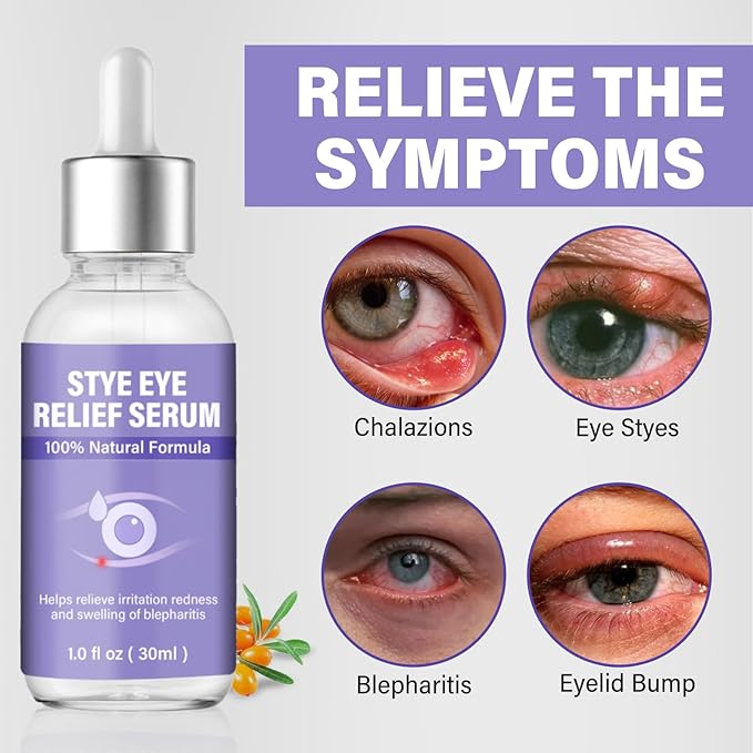 Stye Eye Treatment, Natural Stye Relief Serum, Gently Cleanses Lashes and Eyes, Chalazion and Blepharitis Treatment，Relieves Eye Irritation