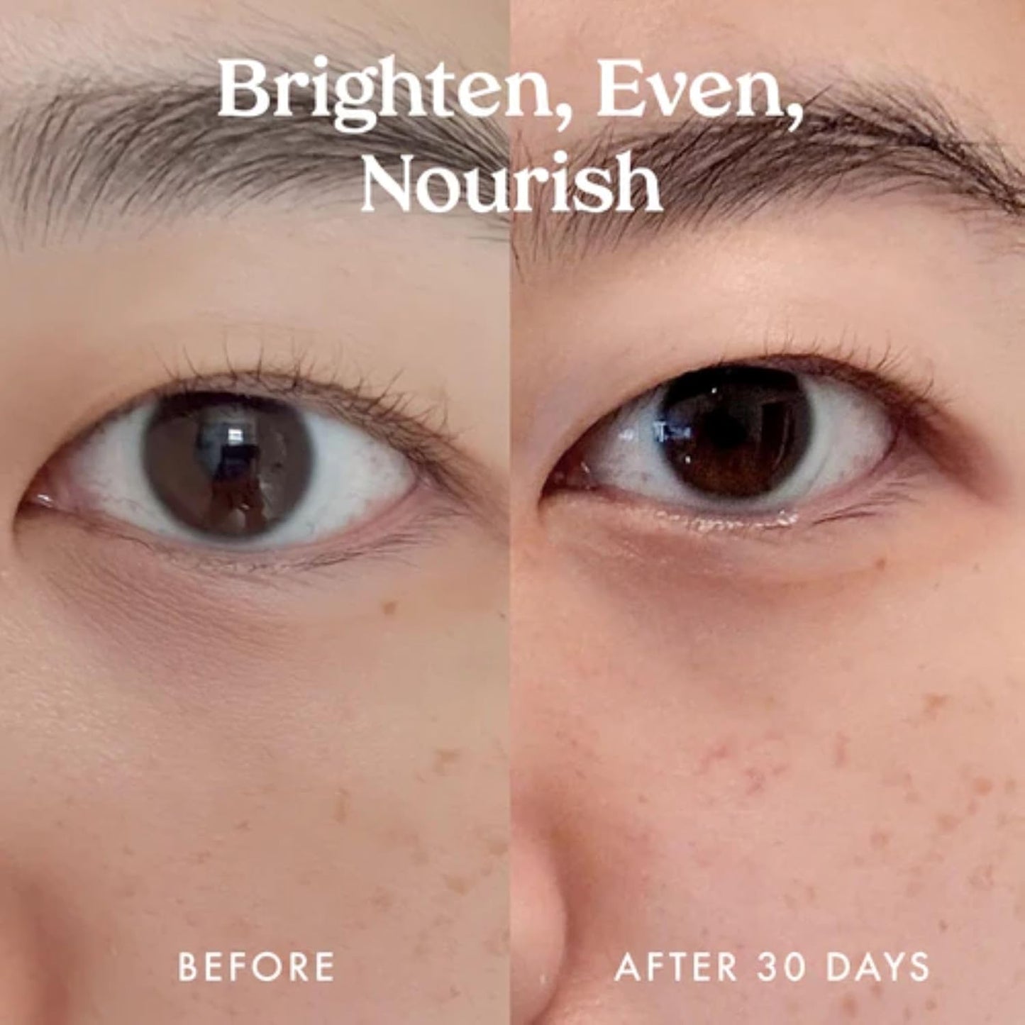 Kopari Ceramide & Retinol Dual-Core Eye Balm – Targets Fine Lines, Texture & Puffiness with Encapsulated Retinol, Ceramides & Squalane – Hydrating, Brightening, Anti-Aging Under Eye Treatment