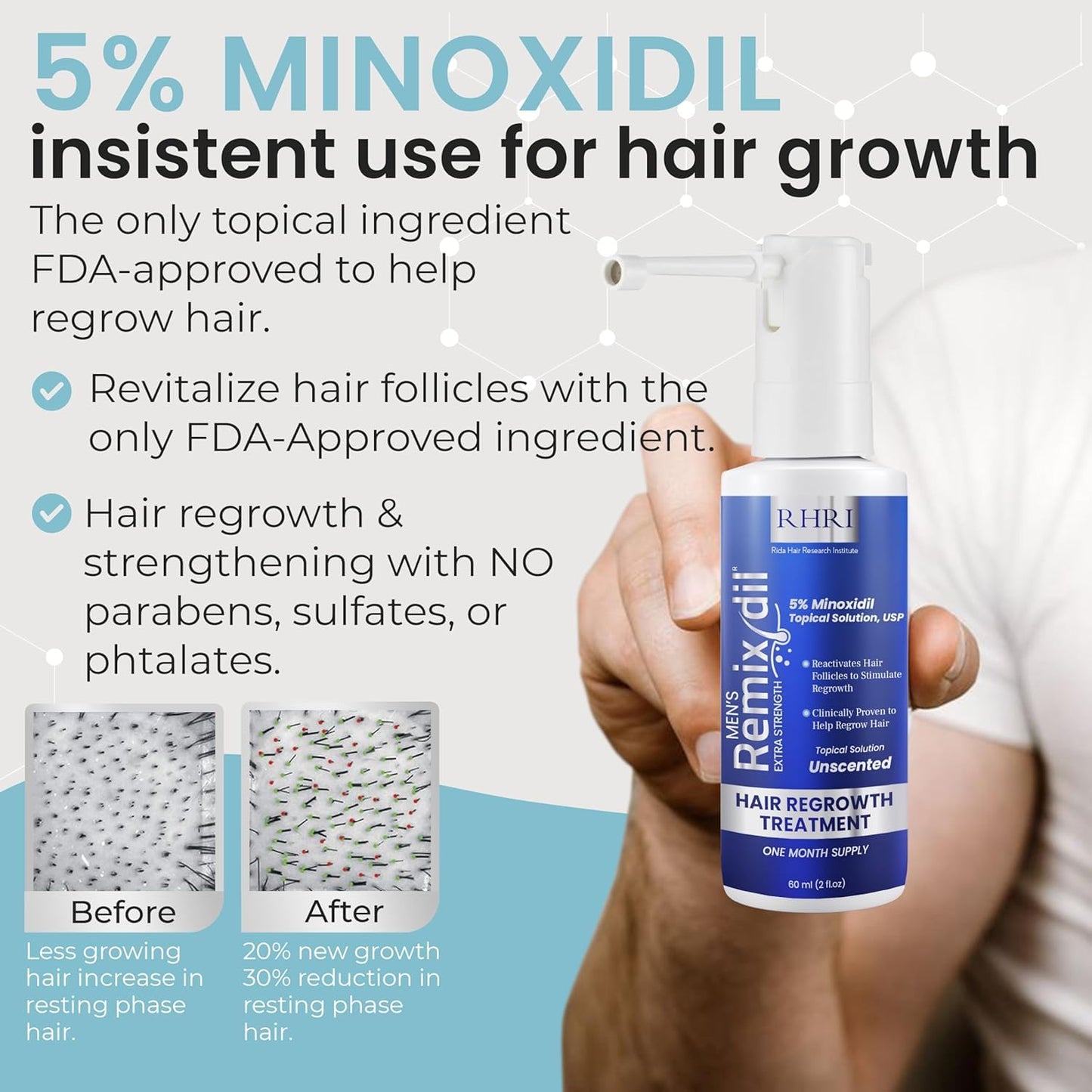 5% Minoxidil for Men Hair Regrowth Spray – Minoxidil Thicker & Fuller Topical Solution for Hair Loss Treatment, Follicle Reactivation - 60 ml (Pack of 2)