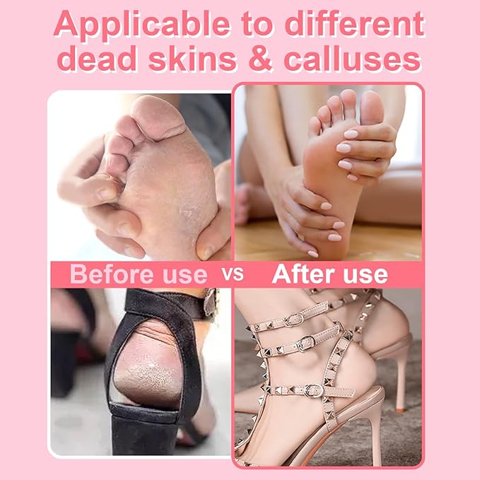 Electric Foot File - Callus Remover for Feet,Professional Pedicure Tool for Dead Skin and Calluses,Adjustable Speed Foot File with 60 Pcs Sandpaper Discs - Pink