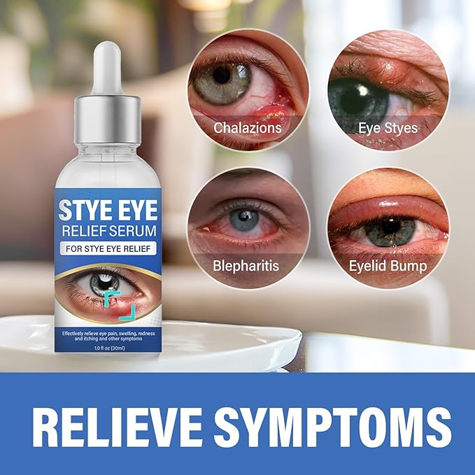 St＿ye Eye Treatment, Natural Eye Serum for Chalazion and Blepharitis Treatment, Leading to Soothed and Restored E-ye Areas, 1 Fl.oz