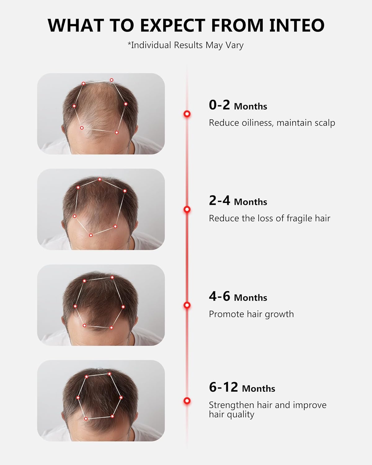 Red Light Therapy for Hair Growth, Laser Hair Growth Cap for Hair Loss, Rechargeable Battery- FDA Cleared Hair Growth for Men & Women, Wireless Red Light Hair Therapy, 162 Lasers