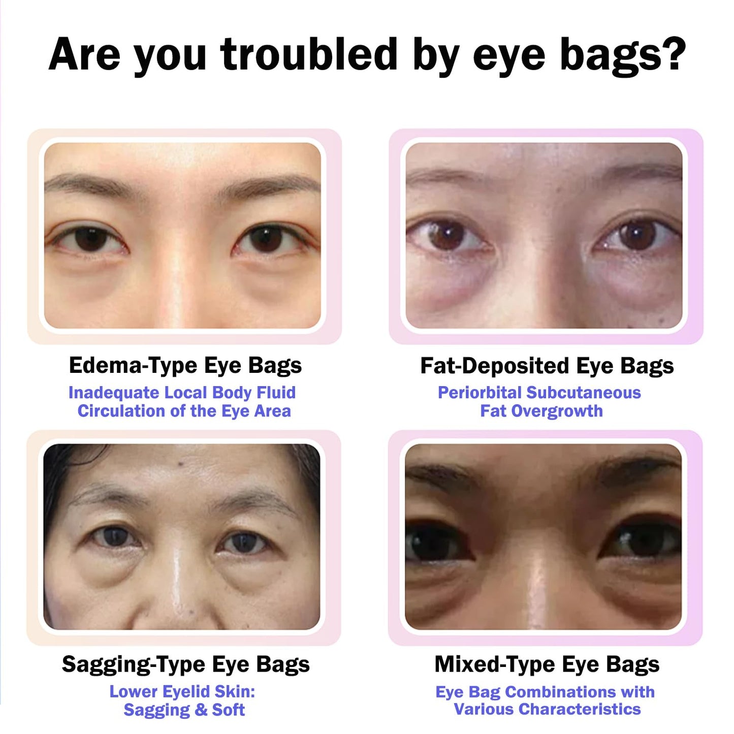 Anti Aging Eye Cream with Hyaluronic Acid & Vitamin E – Hydrating Under Eye Cream for Visible Wrinkles & Bag Appearance, Helps Visibly Tighten & Reduce Puffiness