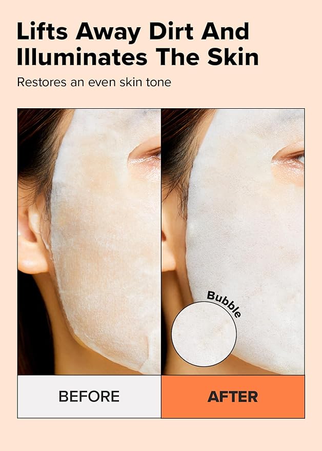 I DEW CARE Face Sheet Mask - Glow Up Bubbles | Vitamin and Niacinamide, Daily Skin Care,Facial Treatment, Illuminating, Detox, Moisturizing, Korean Sleeping Face Mask, Hydartion, Anti Wrinkle, 5ea