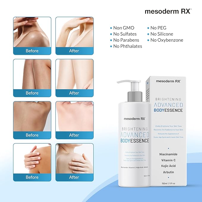 Advanced Skin Hydrating Brightening Body Essence, Niacinamide, Kojic Acid, Vitamin C, Hyaluronic Acid, Alpha Hydroxy Acids - Enhance, Smooth, Reduce Dark Spots, Uneven Skin Tone, 150ml.