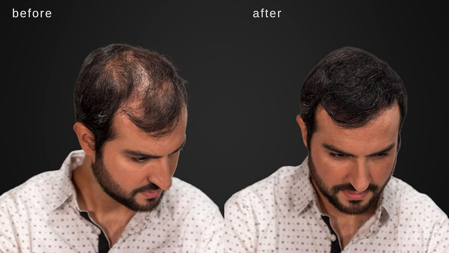 LUXE Hair Building Fibers - Thickening Fibers - CONFIDENCE IN A JAR – 2 Months+ Supply! – Hypoallergenic, Dermatologist Tested – Multiple Colors Available (Auburn)