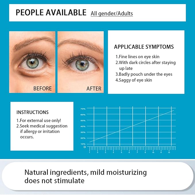 Under Eye Mask Patches, 30 Pairs Collagen Hydrating Moisturizing Smoothing Gel Pads for Puffy Eyes Bags,Dark Circles,Puffiness,Fine Lines,Wrinkles,Anti-Aging Blueberry