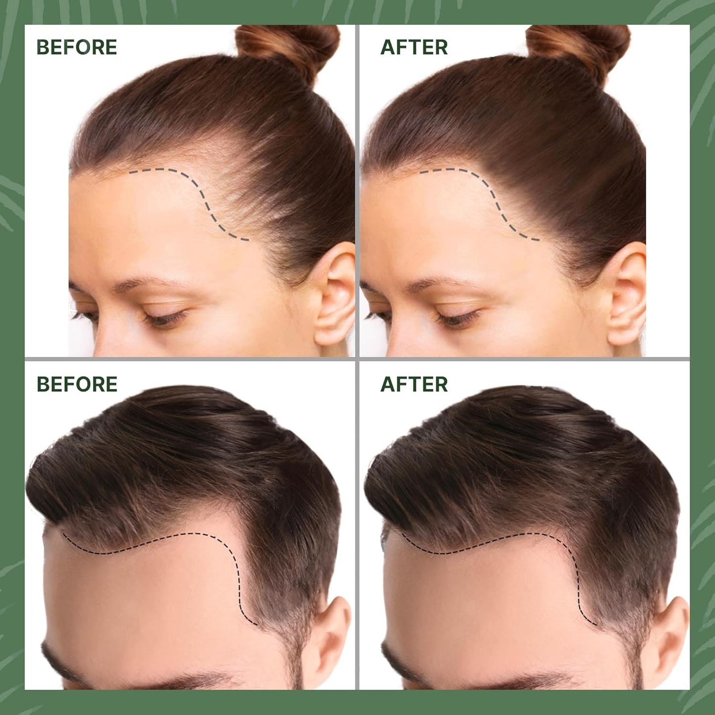 Raw Batana Oil for Hair Growth 4.05 oz - Pure Organic Treatment from Honduras by Dr. Sebi for Thicker, Stronger Hair and Hair Loss Prevention for All Hair Types and Beard Growth by Felero