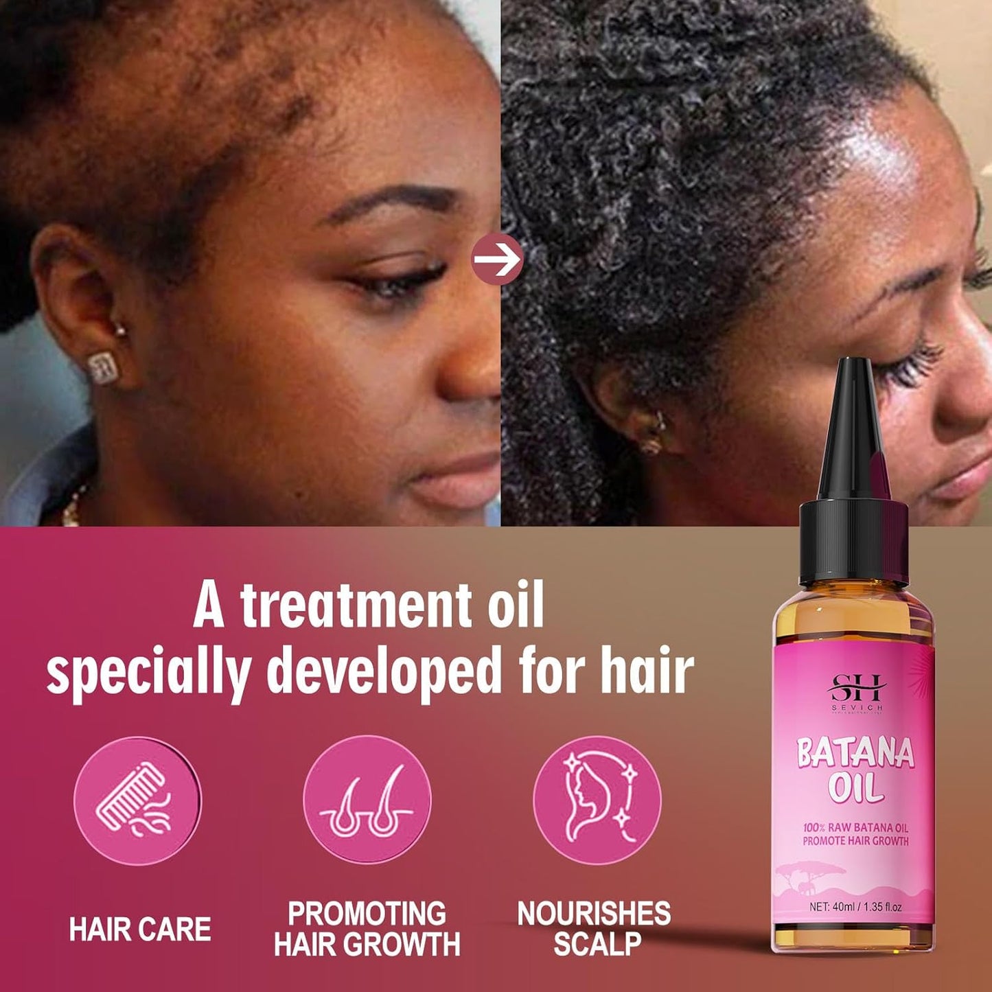 SEVICH 100% Natural Batana Oil for Hair Nourishment: Repair Damaged Tresses, Promote Hair Growth, Suitable for All Hair Types - 1.36 fl.oz