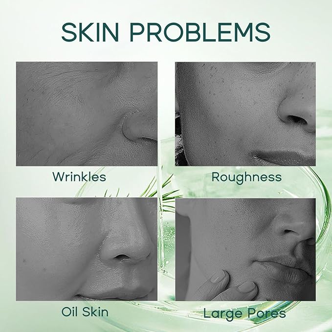 5 Pcs Tea Tree Acne Trea-tment for Face Skin Care Kit - Skin Care for Teens 10-12 - Skincare Gift Set - Acne Kit with Cleanser,Serum,Toner,Gel,Cream - Mother's Day Gifts for Mom